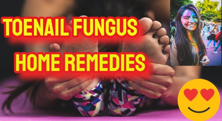 Toenail Fungus Home Remedies