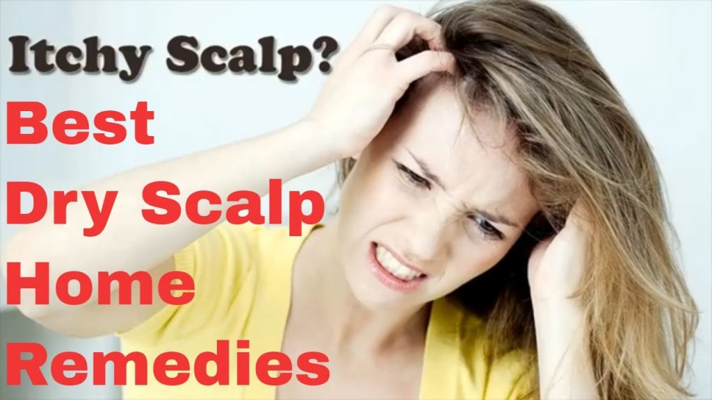 10 dry scalp home remedies